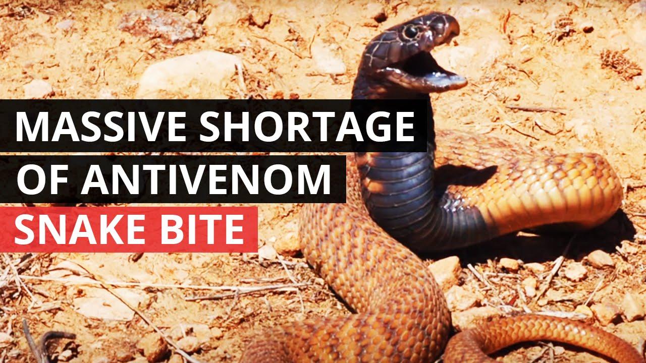 Snake bite Thumbnail